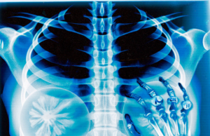 Arthurzim – Peito Falso (feat. Mc Rodrigo do CN, WIU, OLIE) Arthurzim – Peito Falso (feat. Mc Rodrigo do CN, WIU, OLIE)